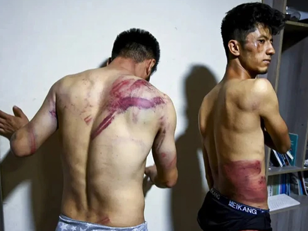 Những bức hình được trả bằng máu: Để chụp được những tấm ảnh này về Afghanistan, có người đã phải chết