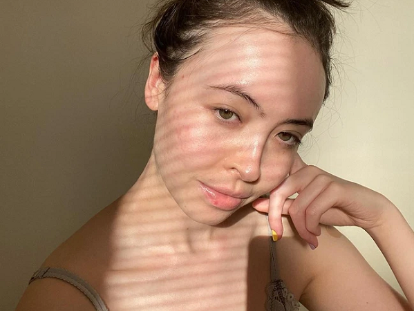 Sự thật: Retinol có thể gây kích ứng gấp đôi vào mùa hanh khô?