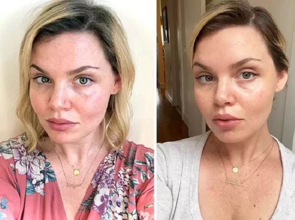Có giá chưa đến 500K, chai serum vitamin C này có gì mà nhận về hơn 57.000 đánh giá 5 sao trên Amazon?