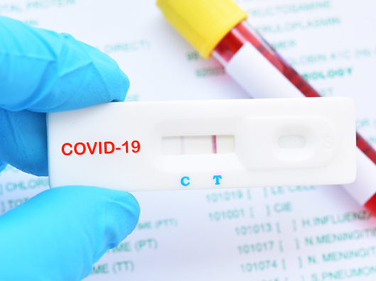 Biến thể họ hàng của Delta gây lo ngại vì có dấu hiệu lan rộng