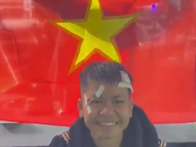 Nguyễn Thị Thu Nhi phải đến viện khâu 5 mũi sau khi giành được chiếc đai thế giới lịch sử