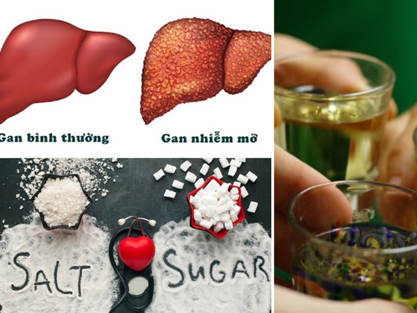 Người bị gan nhiễm mỡ nên kiêng gì?