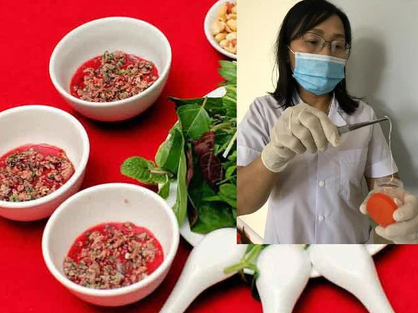 Thích ăn tiết canh, 1 nam giới 'lôi' được giun dài từ đùi