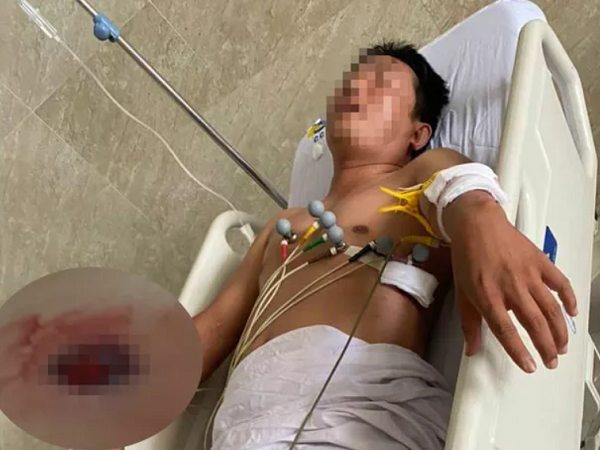 Người đàn ông ở Củ Chi bị bắn 4 phát sau khi thách đối phương 'bắn đi'