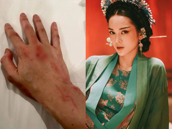 Karik đăng bàn tay đầy máu giữa lúc vướng nghi ngờ hẹn hò, phản ứng của Quỳnh Lương càng bất ngờ hơn