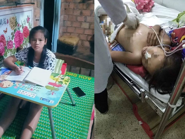 Bé gái 11 tuổi gặp tai nạn kinh hoàng, thân dưới dập nát: Nghị lực khiến bác sĩ ngây người