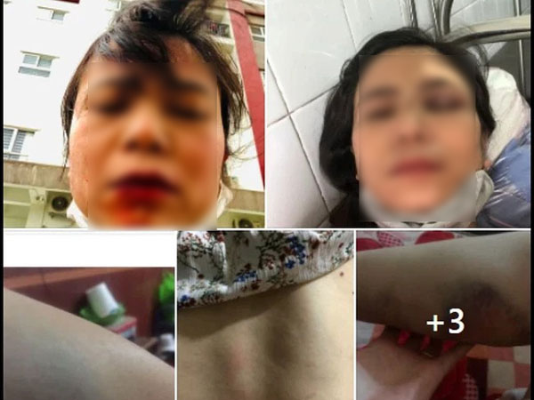 Lấy chồng 8 năm bị lừa sạch tài sản, vợ đòi nói chuyện phải trái thì chồng chạy đến tận nhà ngoại đánh đến nhập viện, khủng khiếp nhất là tin nhắn tiết lộ bí mật của tiểu tam