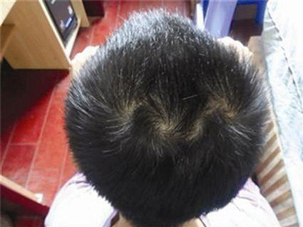 Đếm xoáy tóc đọc vị tương lai cực chuẩn mỗi người