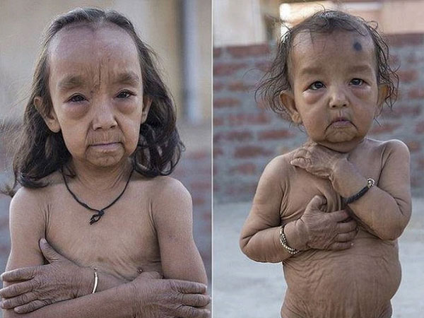 Hai chị em 7 và 18 tháng tuổi mang gương mặt già hơn cả cha mẹ, cuộc sống mỗi ngày gây xót xa