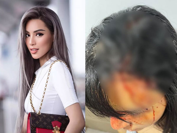 Bạn thân tiết lộ chi tiết vụ bạo hành của siêu mẫu Khả Trang: Bị chồng sắp cưới tra tấn như thời trung cổ, thậm chí còn cắt tóc, dí đầu vào bồn cầu?