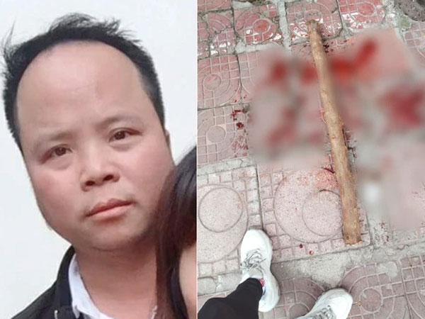 Đánh tình địch chấn thương sọ não, nát 2 chân ngay trên đường phố Hà Nội