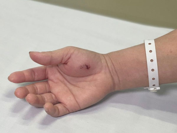 Người phụ nữ Hà Nội nhiễm độc phải cấp cứu vì lý do khiến bác sĩ cũng... ngỡ ngàng