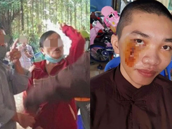 Bị đánh vào mặt, 'tu sĩ' Tịnh thất Bồng Lai đòi bồi thường 3 tỷ