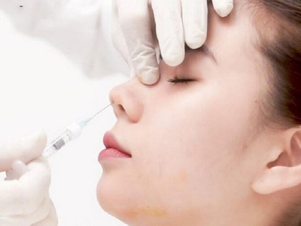 Cô gái hoại tử da mặt sau khi tiêm filler nâng mũi tại một cơ sở làm đẹp