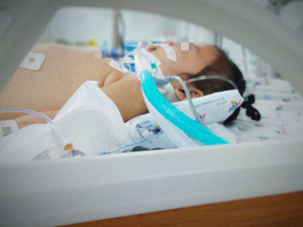 Bé gái 4 tuổi tắc ruột, nguy kịch vì mắc hội chứng 'công chúa tóc mây'