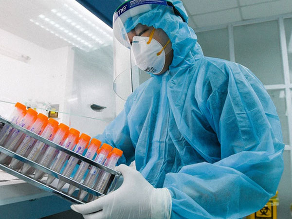 CDC Hà Nội thông tin 'nóng' về việc mua kit test Covid-19 của Công ty Việt Á
