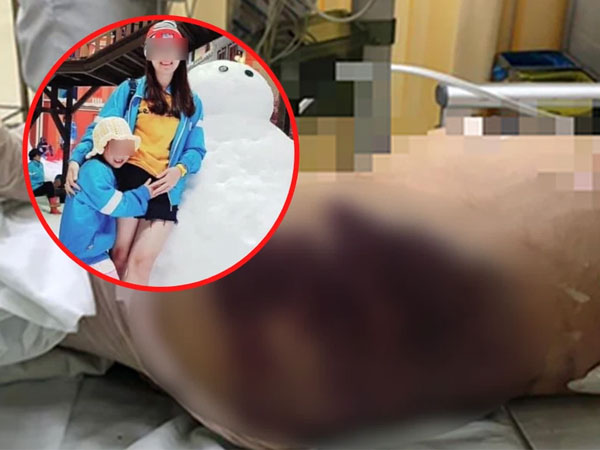 Bé 8 tuổi nghi bị 'dì ghẻ' bạo hành dã man dẫn tới tử vong, mẹ ruột đau xót: Cả năm không được gặp con