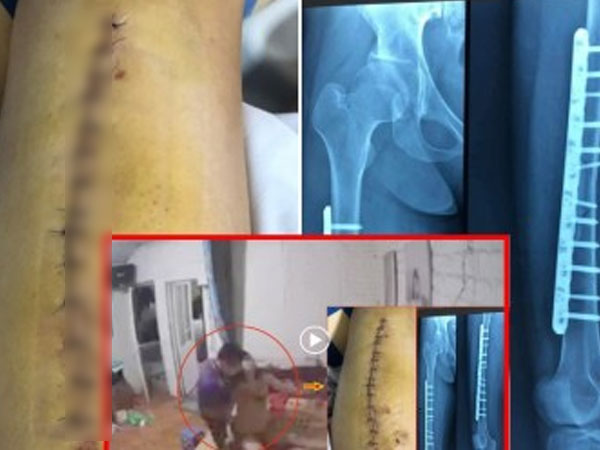 Người phụ nữ la hét 'ối, anh ơi' sau động tác mạnh của nhân viên tẩm quất: Đau đớn cả thể xác và tinh thần, 'mất ăn mất ngủ' vì lời đồn thất thiệt