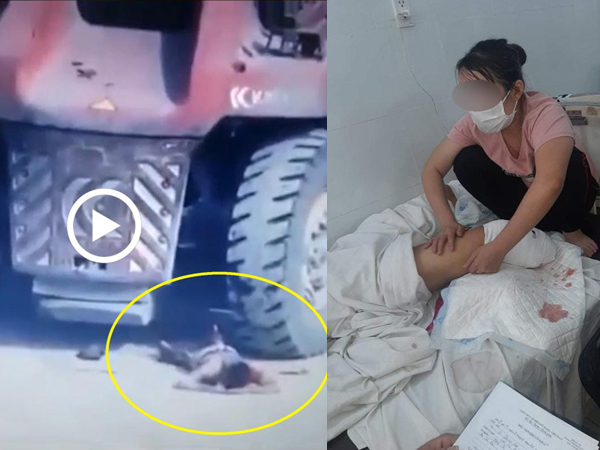Clip: Toàn cảnh vụ tài xế container bị xe nâng cán nát hai chân dẫn đến phải cắt bỏ