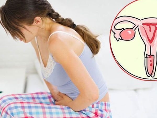 8 kiểu phụ nữ dễ mắc K cổ tử cung cao hơn bình thường: Bạn không nằm trong số đó thì xin chúc mừng