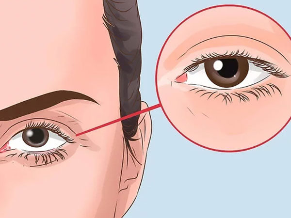 Dấu hiệu trên mặt cảnh báo thận bất ổn