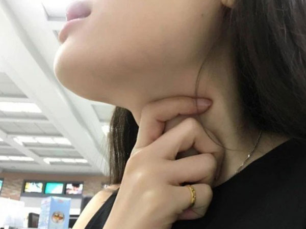 Nữ sinh trẻ mắc sùi mào gà trong cổ họng khẳng định chưa quan hệ, nguyên nhân sau đó gây bất ngờ