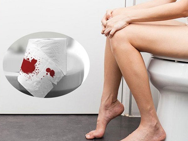 Sáng thức dậy, đi vệ sinh gặp 3 dấu hiệu bất thường này cảnh báo K sớm, cần đi khám ngay để cứu mình khỏi 'án tử'