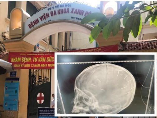 Vụ bé gái bị ghim 9 chiếc đinh trong đầu: Cục Trẻ em hé lộ nội dung cuộc điện thoại cầu cứu