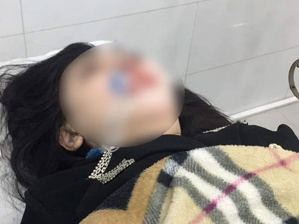 Vừa khỏi Covid-19, cô gái 22 tuổi đi nâng mũi bị hôn mê sâu, nguy cơ trở thành người thực vật