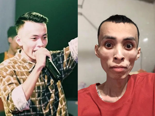 Căn bệnh ung thư khiến nam rapper Chú Nghi qua đời ở tuổi 27 nguy hiểm thế nào?