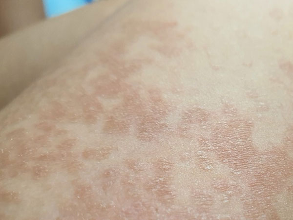Ảnh bìa bài viết 807287