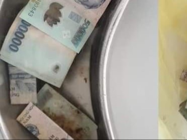 Hy hữu người phụ nữ phải cấp cứu vì nuốt 12,5 triệu đồng tiền polyme vào bụng