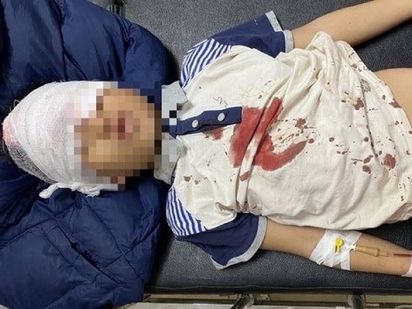 Báo động tai nạn do pháo tự chế: Vì một cái Tết bình yên