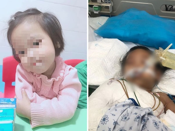 Bé gái 3 tuổi bị đinh cắm vào đầu đã qua cơn nguy kịch, có phản xạ tay chân