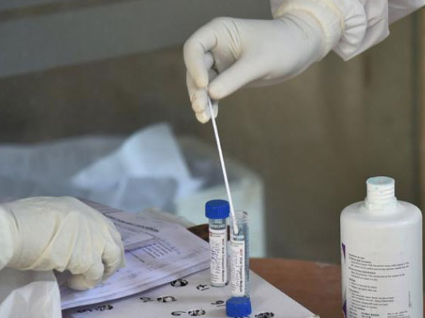 Nhân viên phòng khám bị bắt vì dùng bông lấy mẫu ở 'vùng kín' để test nhanh Covid-19