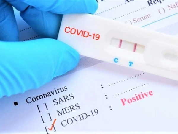 Một doanh nghiệp nhập hơn 3.400 tỷ đồng kit test Covid-19, 'khủng' hơn Việt Á