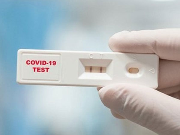 Sau khi tiếp F0, nên test vào lúc nào để có kết quả chính xác nhất?