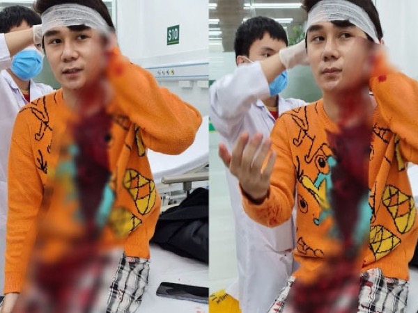 Nam diễn viên phim 'Thương ngày nắng về' bị chém trọng thương