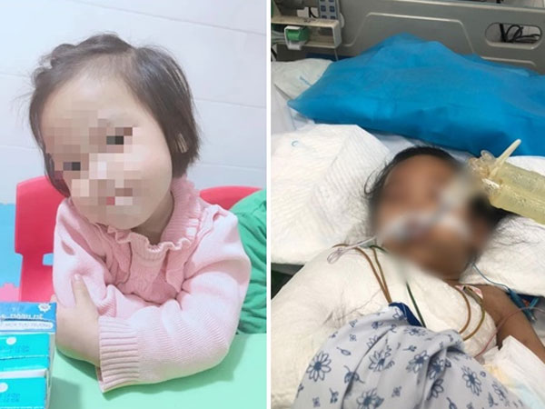 Sức khoẻ bé gái bị nhân tình của mẹ găm 9 chiếc đinh vào đầu ra sao?