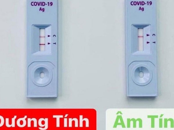 F0 không cần test nhanh Covid hằng ngày cho tốn kém, chỉ cần test vào 2 thời điểm này