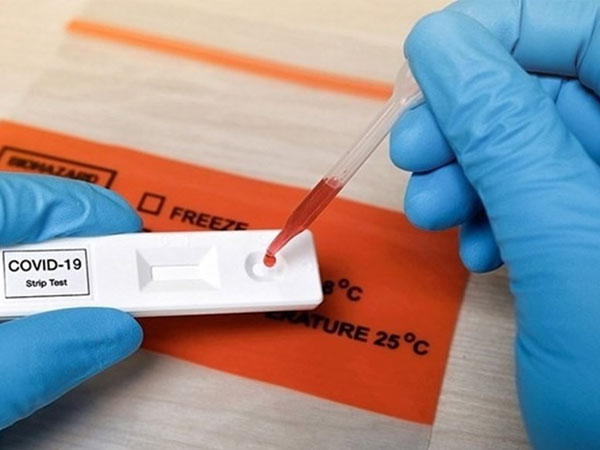 7 biến chứng kéo dài hậu COVID-19 và cách khắc phục