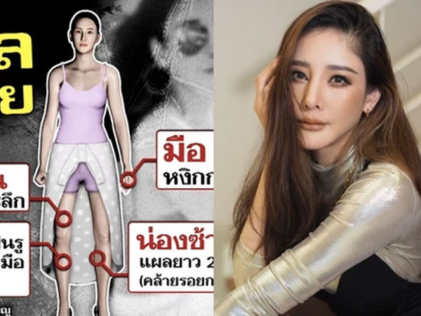 NÓNG: Công bố chi tiết về loạt vết thương trên thi thể nữ diễn viên 'Chiếc Lá Cuốn Bay', cô bạn thân sẽ bị khởi tố?