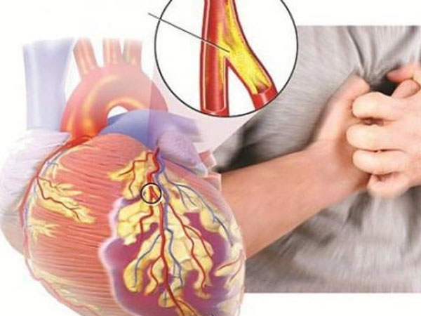 Nhạc sĩ Ngọc Châu đột ngột qua đời ở tuổi 55: Bệnh suy tim nguy hiểm như thế nào?