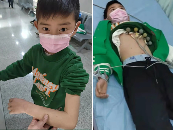 Bé trai vượt hơn 400km, chấp nhận đau đớn để bác sĩ lấy 30 ống máu cứu mẹ
