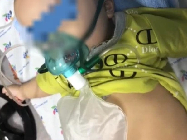 Cứu sống bé 5 tháng tuổi mắc COVID-19 gây viêm thanh quản cấp, suy hô hấp nặng