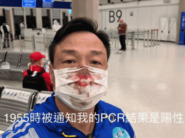 Sao Hong Kong 54 tuổi chảy máu mũi đầm đìa vì bị chọc dụng cụ quá mạnh khi đi test Covid-19