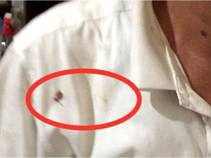 Linh tính của người cảnh sát khu vực trước vết máu trên áo kẻ thủ ác giấu mặt