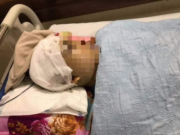 Phó chủ tịch xã bị giám đốc doanh nghiệp đánh trọng thương