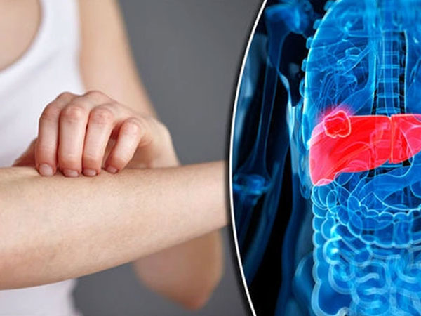 Xuất hiện '2 đau 2 ngứa' trên cơ thể cảnh báo K gan sớm, đi khám ngay có thể 'cứu' bạn khỏi án tử