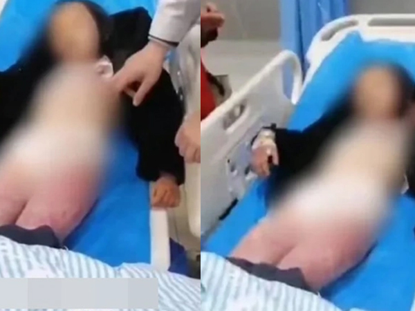 Mẹ dùng móc treo quần áo đánh con gái đến nhập viện, lý do khiến ai cũng 'sôi máu'
